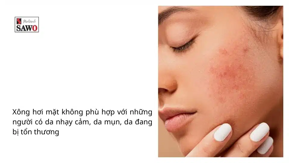 7 Tác hại của xông hơi mặt không đúng cách mà bạn cần biết 5 Tác hại của xông mặt không đúng cách gây kích ứng da