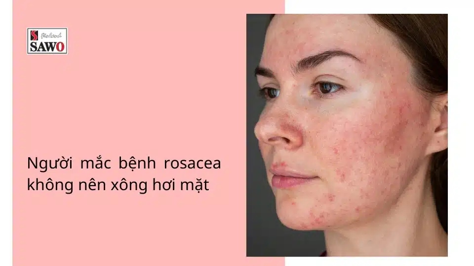 7 Tác hại của xông hơi mặt không đúng cách mà bạn cần biết 6 tác hại của xông hơi mặt